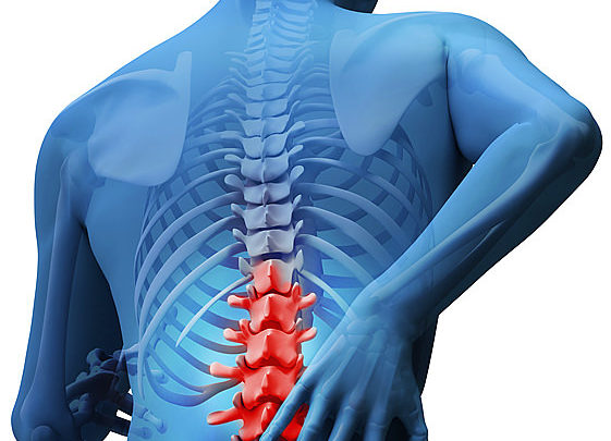 Lumbalgia: más que un dolor de espalda